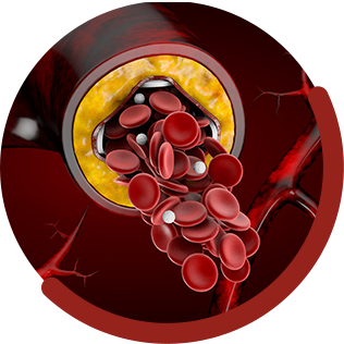 Cholesterol